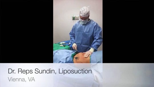 Liposuction Videos